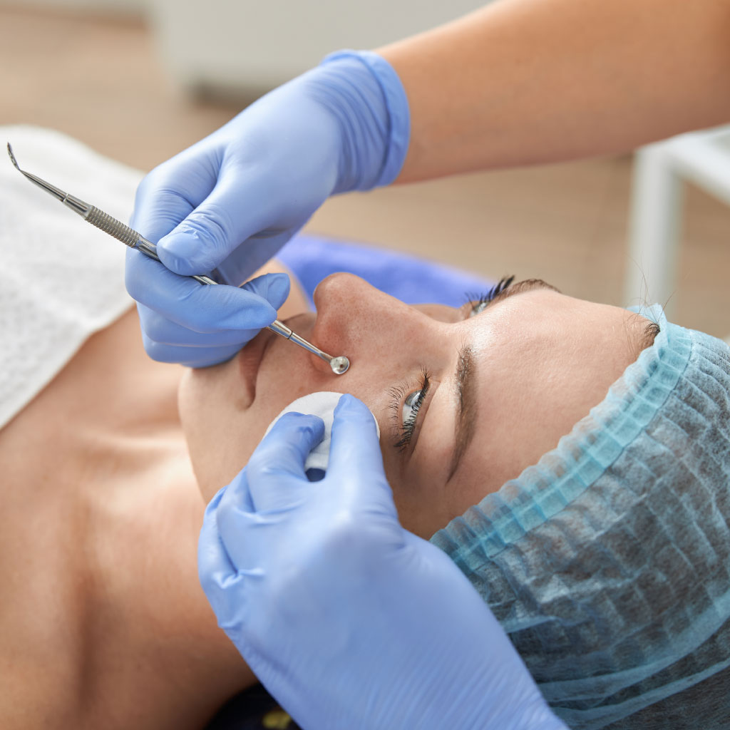 Intervention de chirurgie esthétique du visage en Tunisie dans une clinique privée spécialisée avec Luxor Health